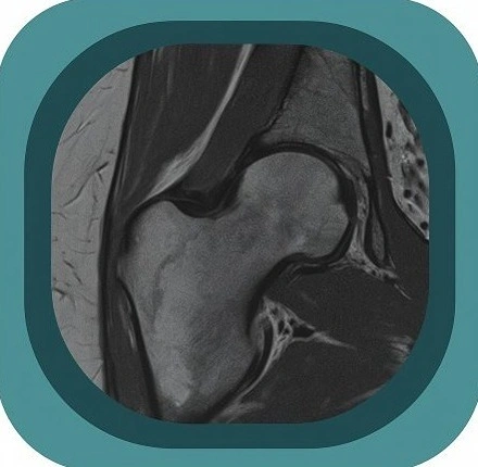 MRI hip anatomy icon